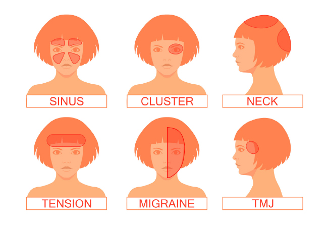 Looking for Headache Relief? Try Physical Therapy