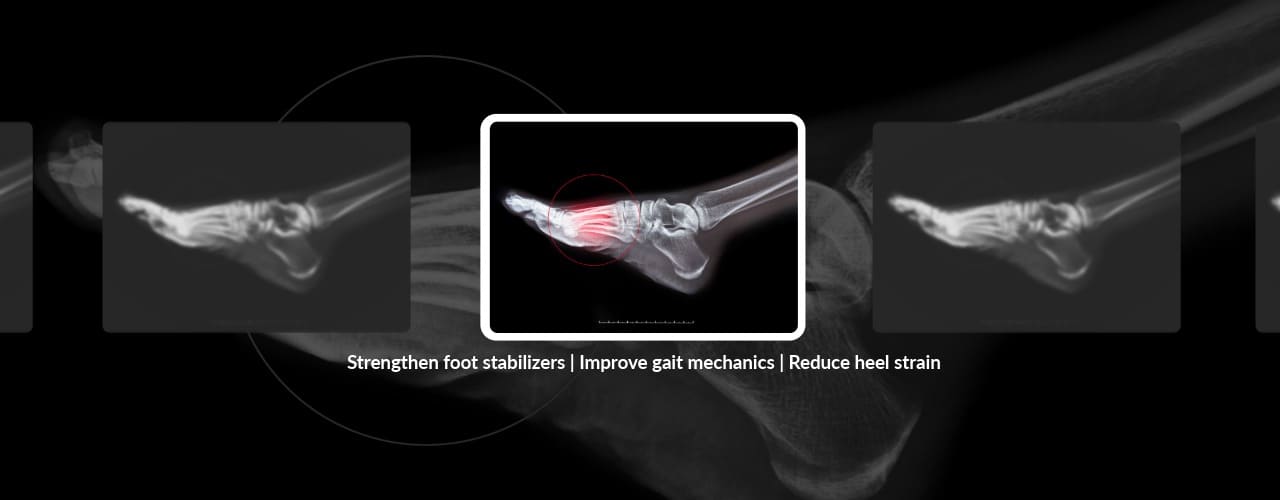 What Foot Pain During Walking Could Mean