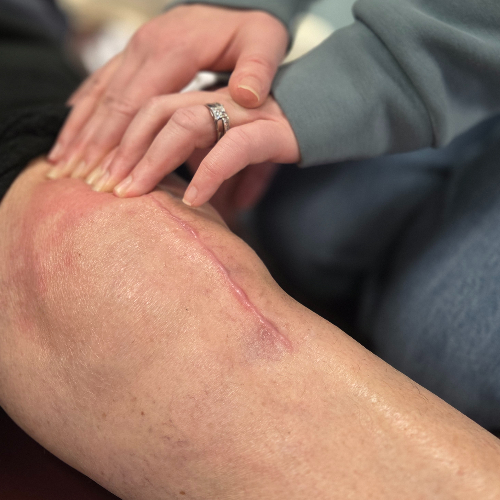 joint-replacement-rehab-balance-albanese-physical-therapy-new-birghton-pa